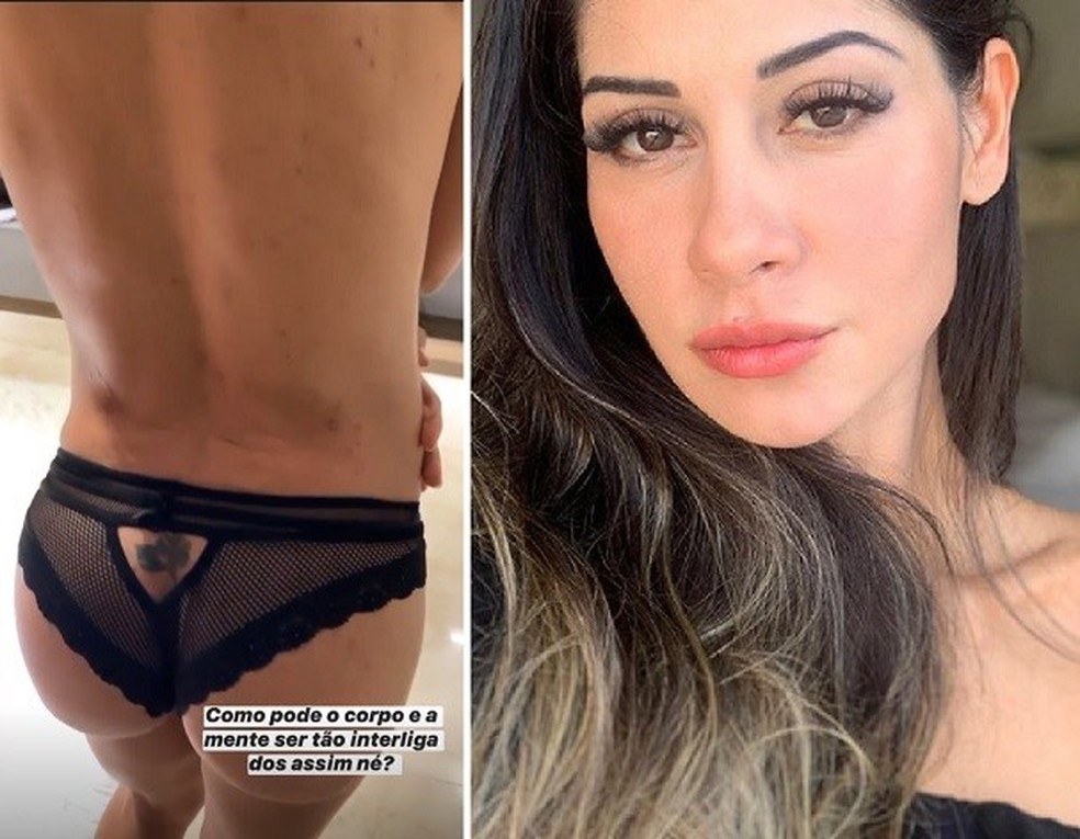Alergia emocional: o que é (Foto: Reprodução / instagram) — Foto: Glamour