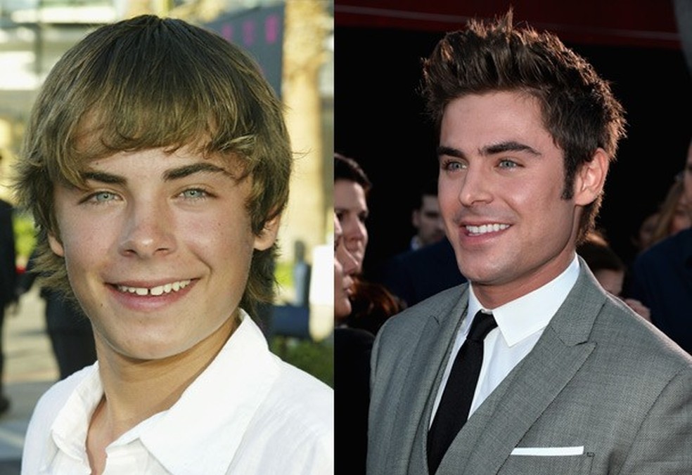 Zac Efron (Foto: Getty Images) — Foto: Glamour