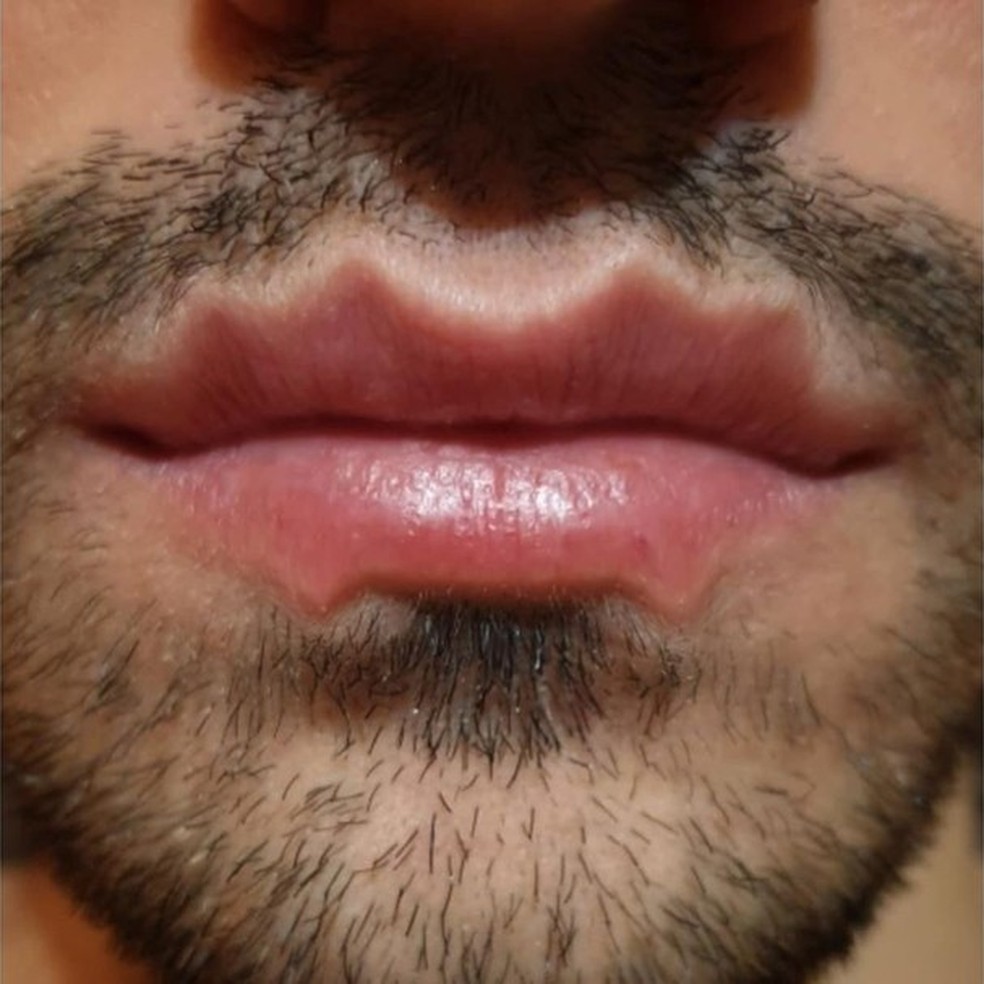 Devil Lips (Foto: Reprodução / Instagram) — Foto: Glamour