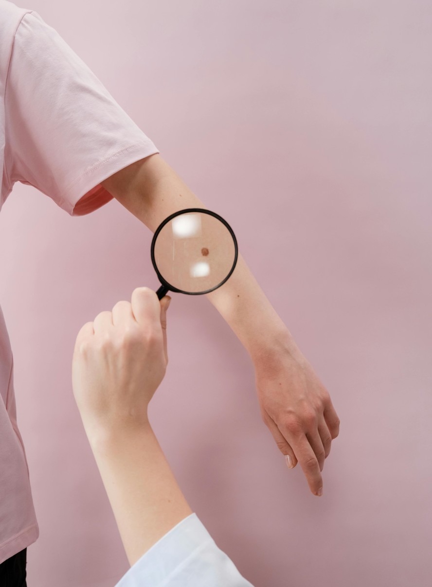 90 milhões de brasileiros nunca foram ao dermatologista, revela pesquisa