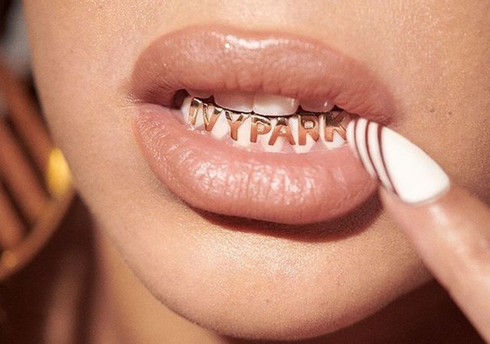 Joia para os dentes? Beyoncé aprova