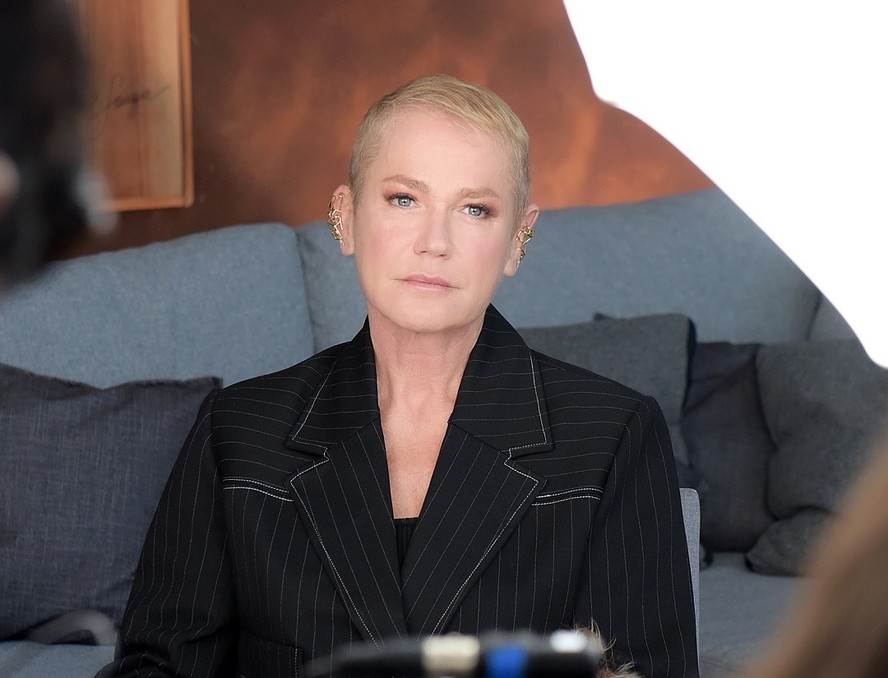 Alopécia androgenética: entenda o diagnóstico revelado por Xuxa