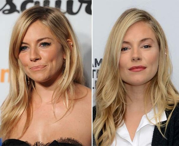 sienna miller plastic surgery Image 1
