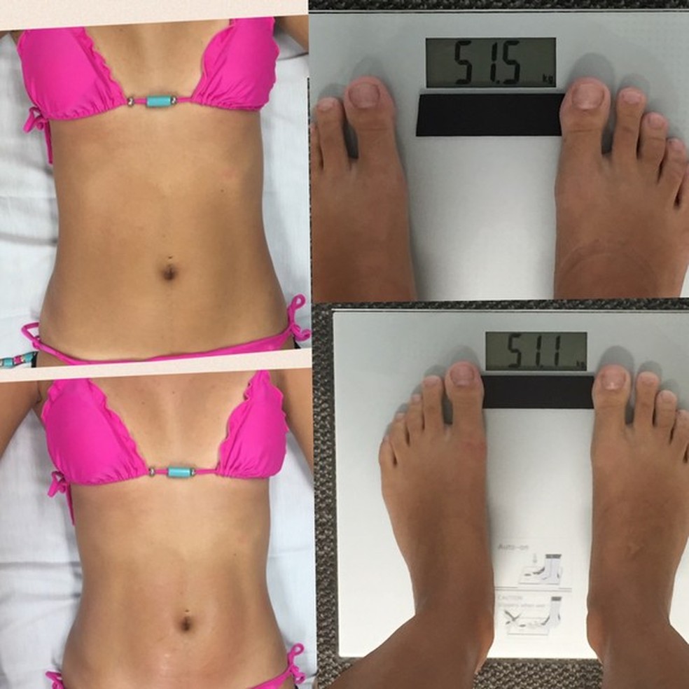 Quase meio quilo do antes e depois da massagem (Foto: Arquivo Glamour) — Foto: Glamour