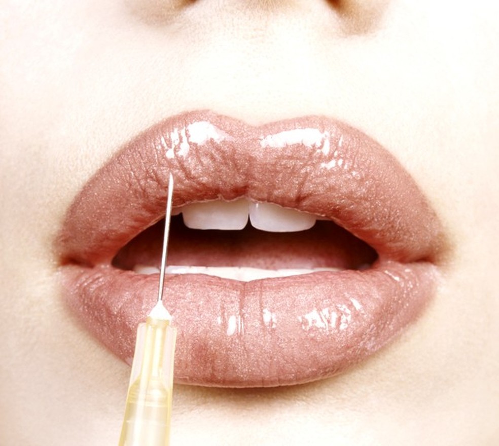 As mil e uma funções do botox (Foto: Thinkstock) — Foto: Glamour