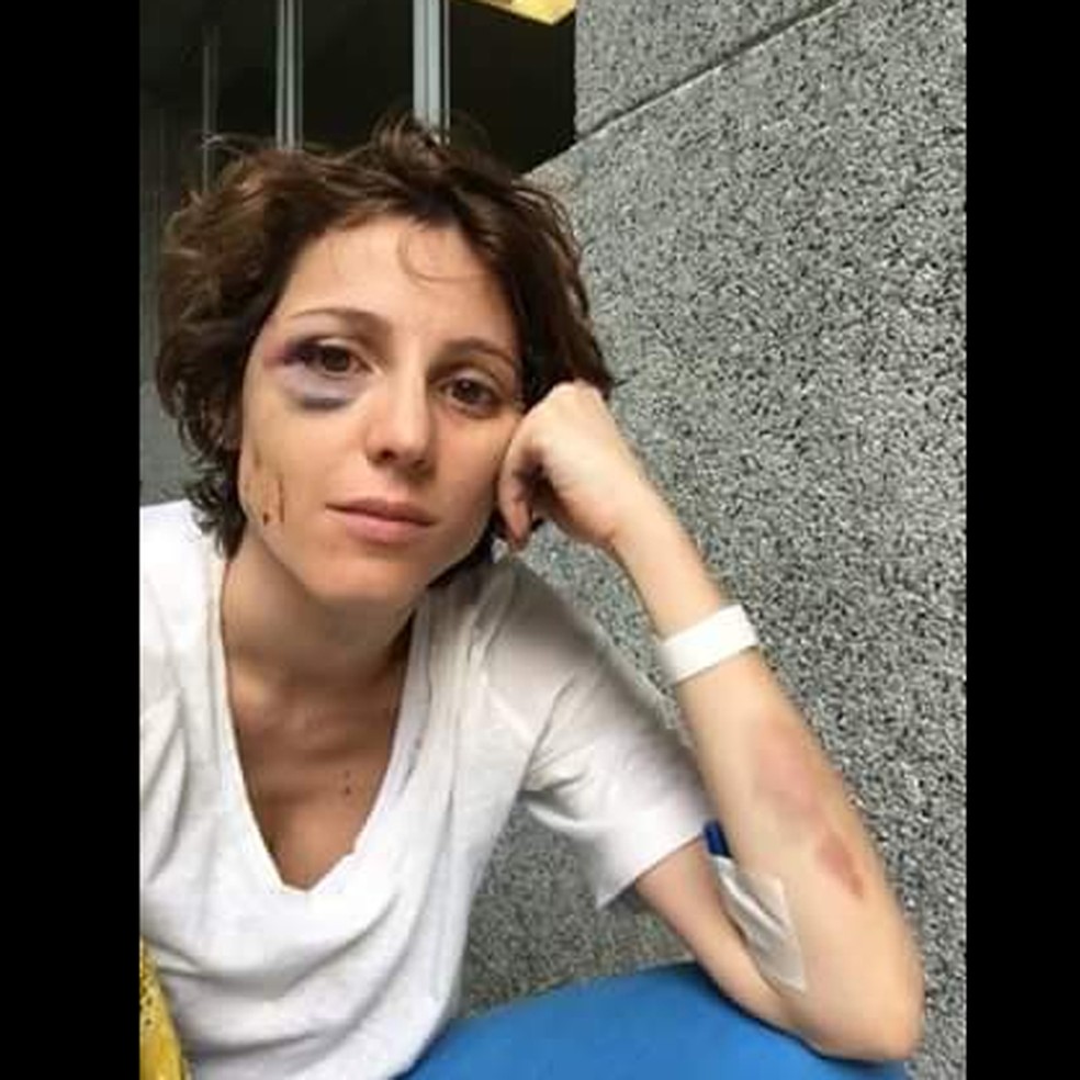 Fernanda foi vítima de violência física dentro de uma balada em SP (Foto: Reprodução/Facebook) — Foto: Glamour