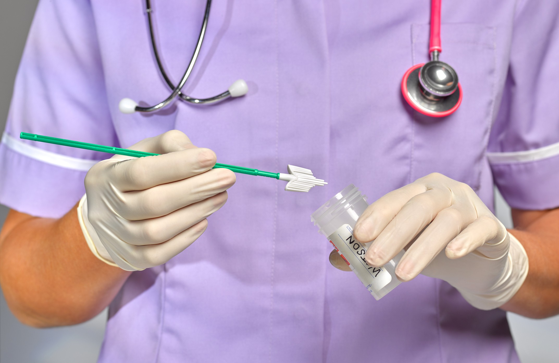 DNA-HPV: entenda o exame que vai substituir o papanicolau no SUS