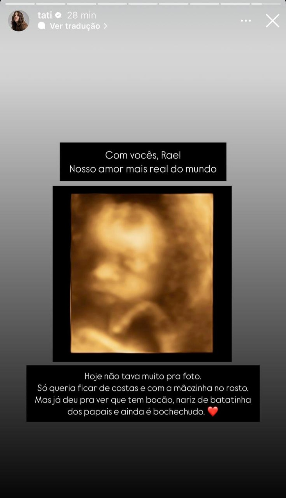 Tati Machado mostra rostinho do filho em ultrassom: "Nosso amor mais real" — Foto: Reprodução/Instagram