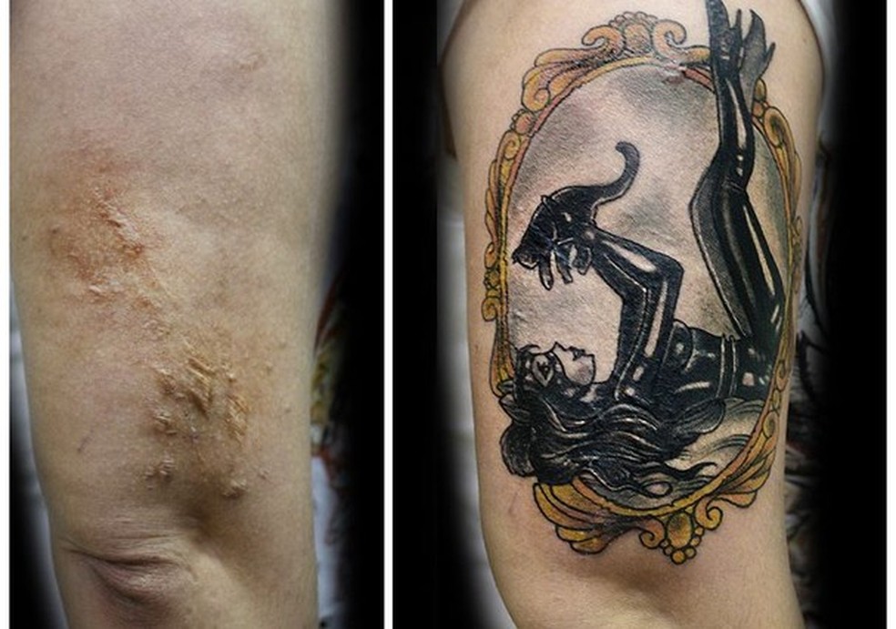 Cicatriz de um ferimento causado por caco de vidro durante tentativa de homicídio (Foto: Reprodução Facebook) — Foto: Glamour