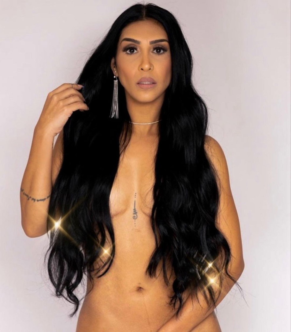 Amanda Djehdian retirou as próteses em 2020 — Foto: Instagram @amandadjehdian