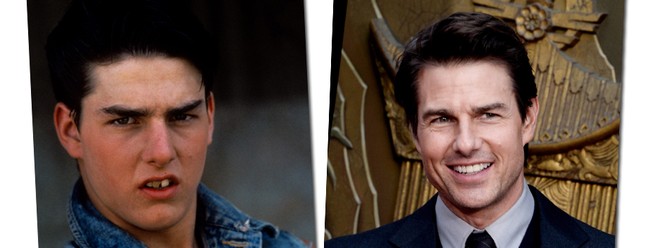 Tom Cruise em 1983 não se parece em nada com o que ele é hoje, né? Bem melhor agora!