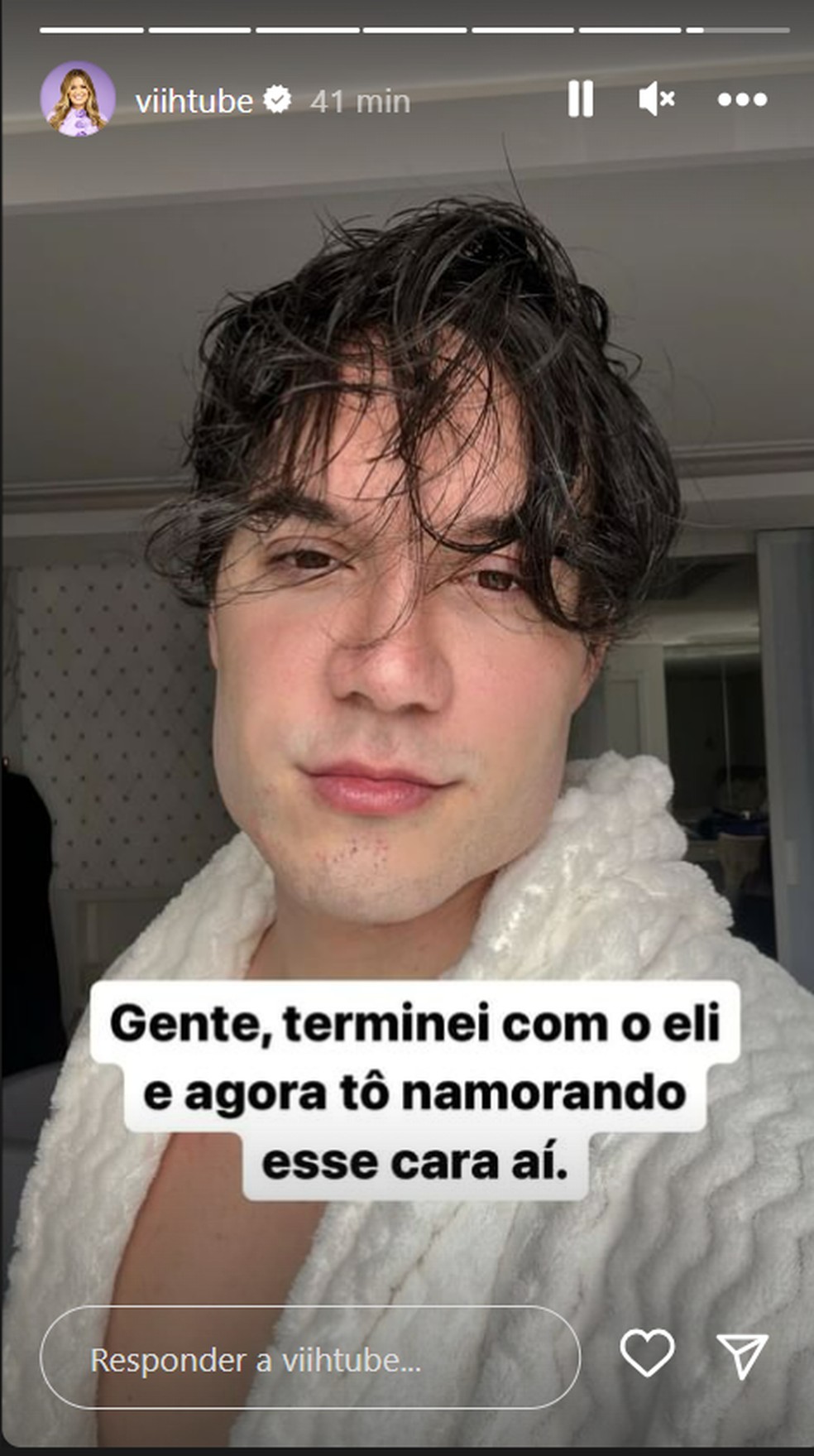 Eliezer retira a harmonização facial e explica o motivo: 'Distorção de ...
