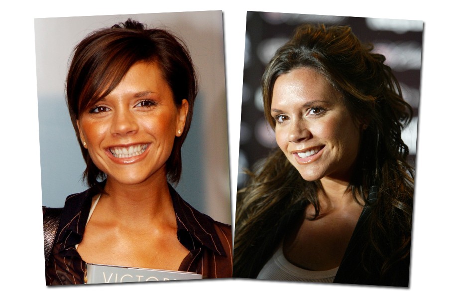 Victoria Beckham quase nunca sorri, mas dá pra ver que deixou os dentes de tamanhos uniformes e mais brancos