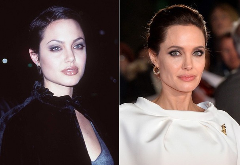 Angelina Jolie também mudou o rosto arredondado (Foto: Getty Images) — Foto: Glamour