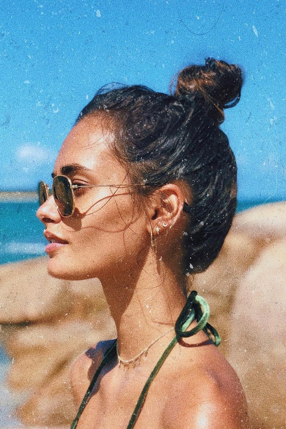 O que fazer quando a pele começa a descascar (Foto: Instagram/Reprodução) — Foto: Glamour