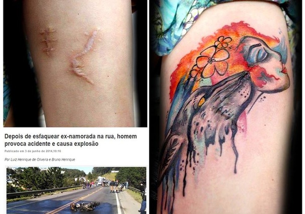 Mais uma tattoo sobre uma cicatriz trágica. (Foto: Reprodução Facebook) — Foto: Glamour