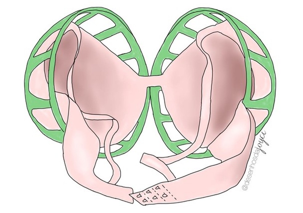 Esfera para lavar sutiã (Foto: Ilustração: Joyce Veiga (@desenhosdajoyce)) — Foto: Glamour
