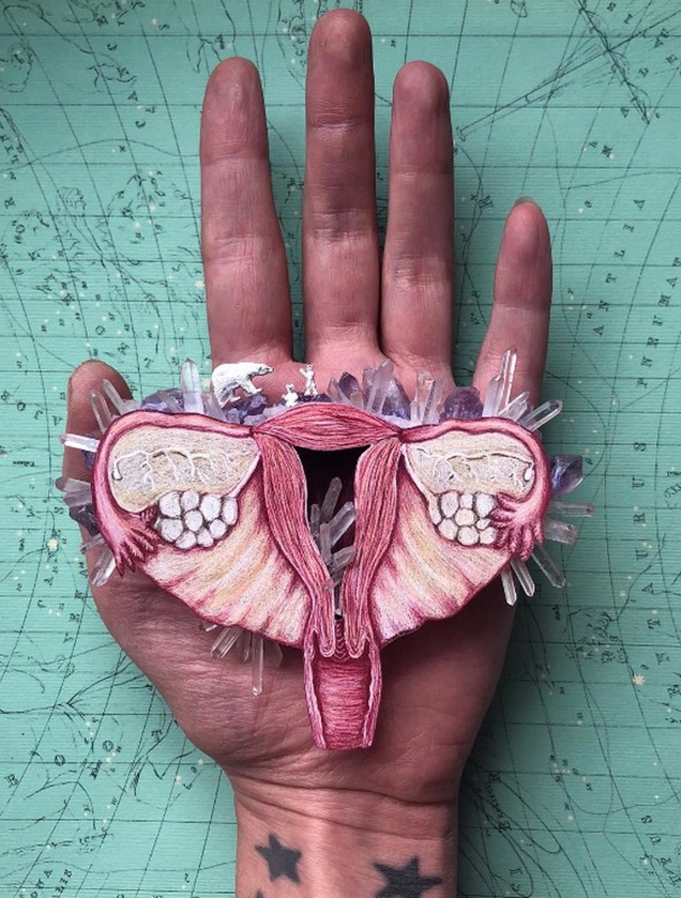 Endometriose afeta 10 a 15% das mulheres em idade reprodutiva (Foto: Reprodução) — Foto: Glamour