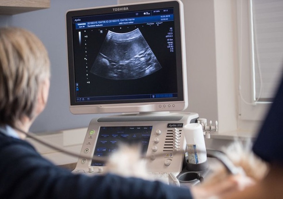 Lei que garante ultrassonografia mamária pelo SUS é sancionada (Foto: Getty Images ) — Foto: Glamour