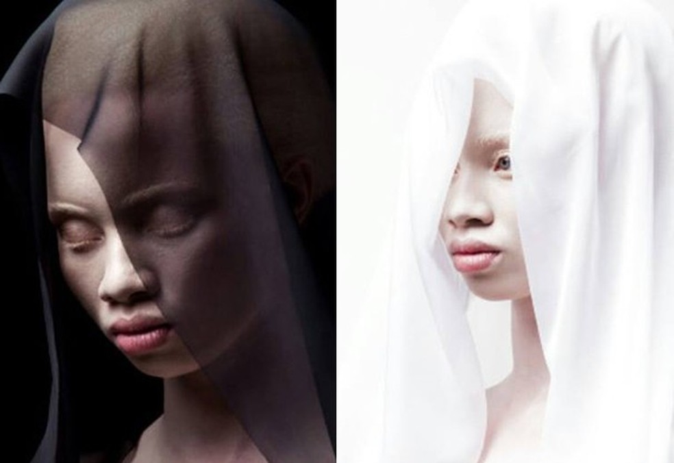 Advogada sul-africana albina vira modelo aos 25 anos