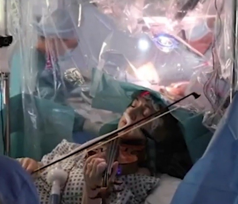 Em Londres, paciente tocou o violino durante cirurgia para que os médicos identificassem as áreas do cérebro responsáveis pela linguagem e movimento - e não as danificassem (Foto: Reprodução/Instagram) — Foto: Glamour