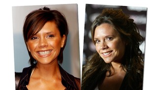 Victoria Beckham quase nunca sorri, mas dá pra ver que deixou os dentes de tamanhos uniformes e mais brancos