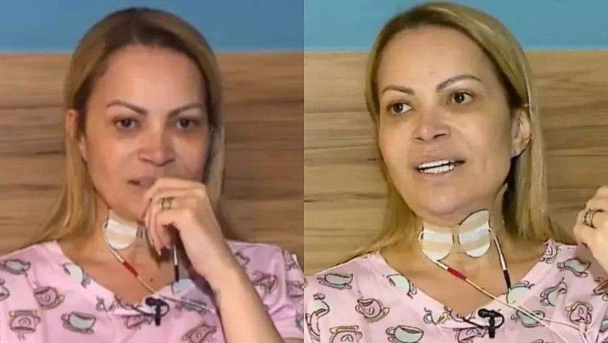 Solange Almeida esclarece repercussão sobre problema de saúde causado por cigarro eletrônico