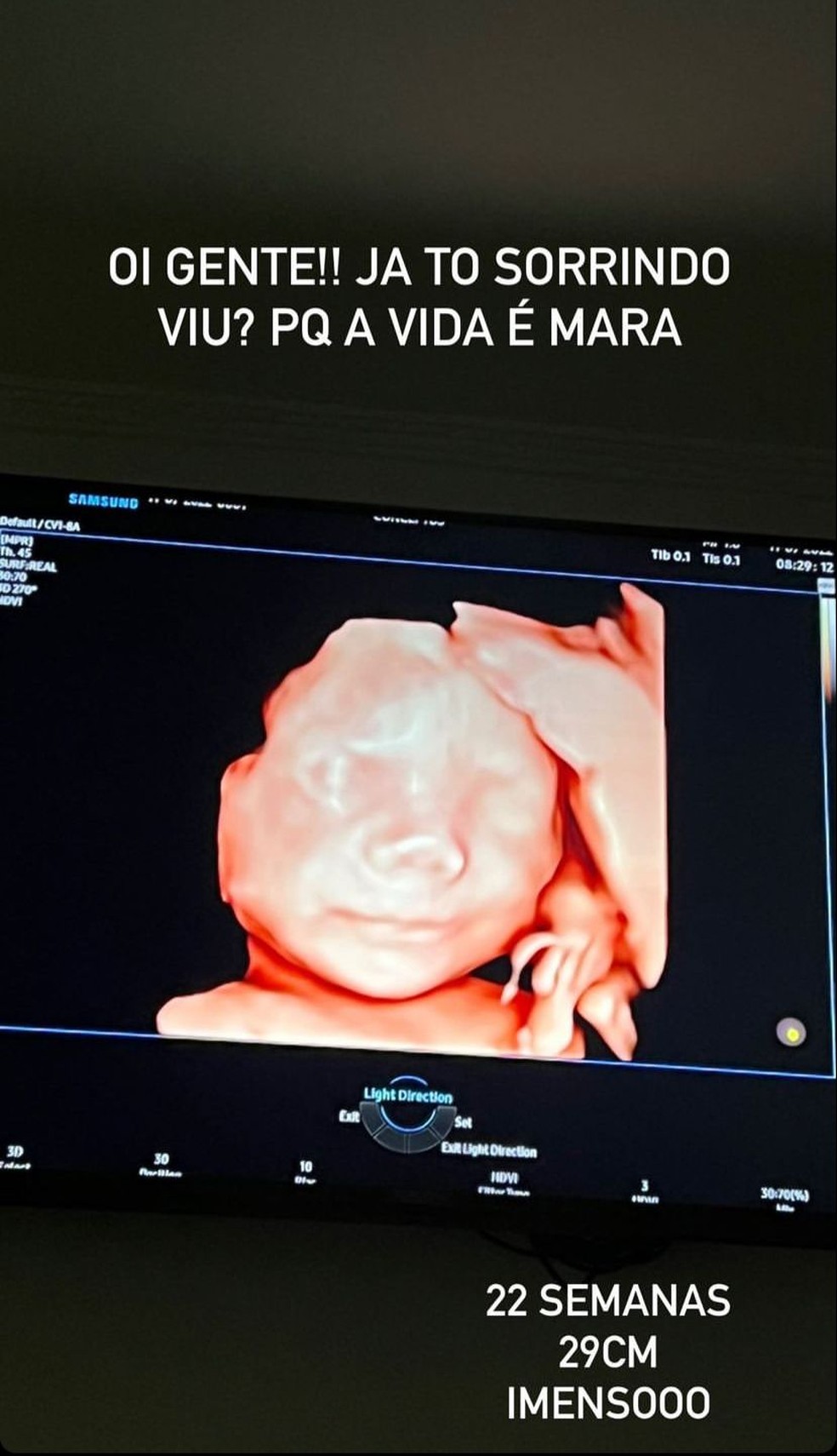 Gabriela Pugliesi compartilha ultrassom — Foto: Instagram @eusougabriela