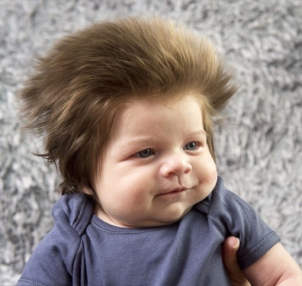 Cox, o bebê mais cabeludo do mundo (Foto: Reprodução) — Foto: Glamour