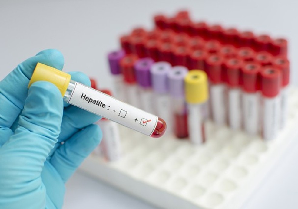Hepatites matam mais que Aids (Foto: Thinkstock Photos) — Foto: Glamour
