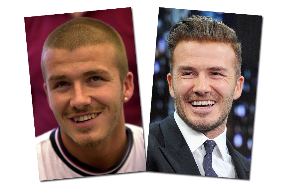 David Beckham fez um bom clareamento e hoje em dia tem os dentes um pouco melhores vai