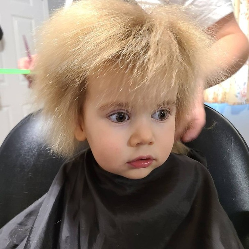 Síndrome do cabelo impenteável (Foto: Reprodução/ Instagram @svetlanakharazi) — Foto: Glamour