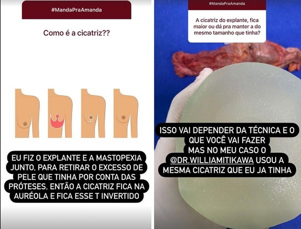 Amanda Djehdian (Foto: Instagram/Reprodução) — Foto: Glamour