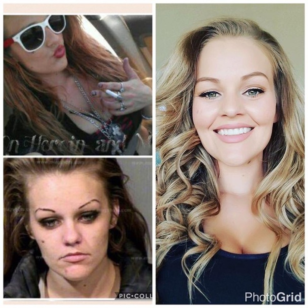 Transformação de mulher após 4 anos longe das drogas é impressionante (Foto: Reprodução/Instagram) — Foto: Glamour