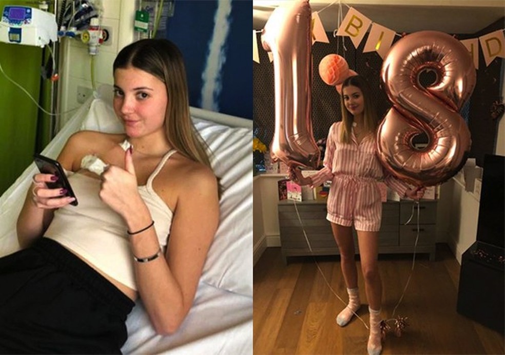 Aos 18 anos, garota tornou-se a mais jovem a morrer de câncer de intestino depois de sentir “dor de barriga” (Foto: Reprodução/Facebook PA Real Life) — Foto: Glamour