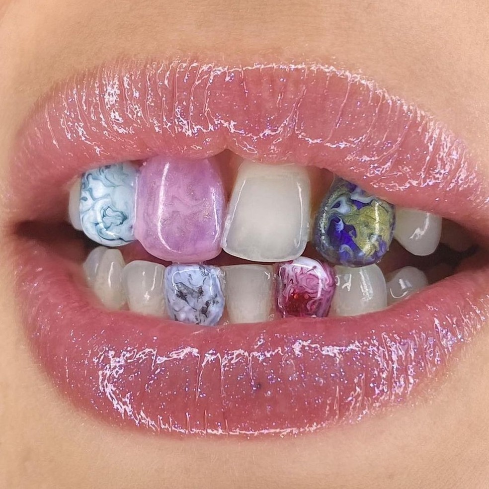 Dente colorido é uma das tendências de beleza — Foto: Reprodução @lisamchlik