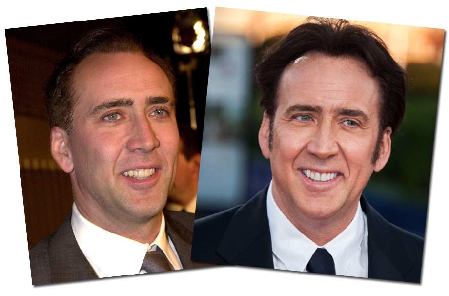 Hoje em dia Nicolas Cage tem os dentes bem mais branquinhos do que antes.. ah, o milagre do clareamento!