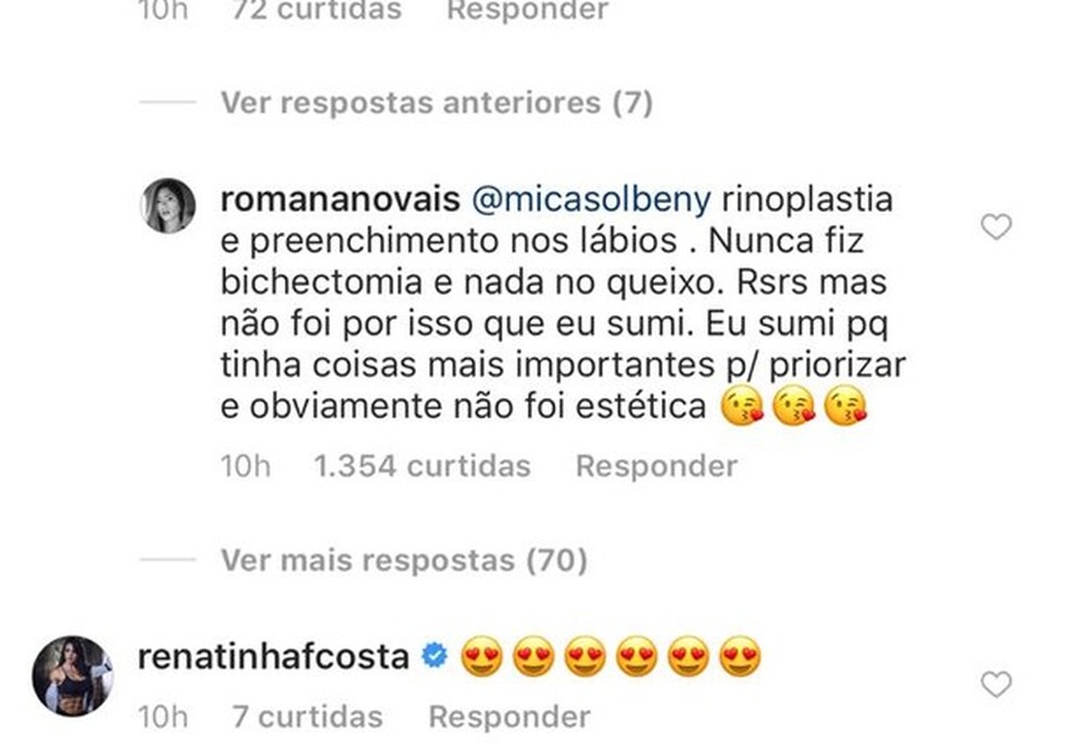 Romana Novais afirma plástica (Foto: Instagram/Reprodução) — Foto: Glamour