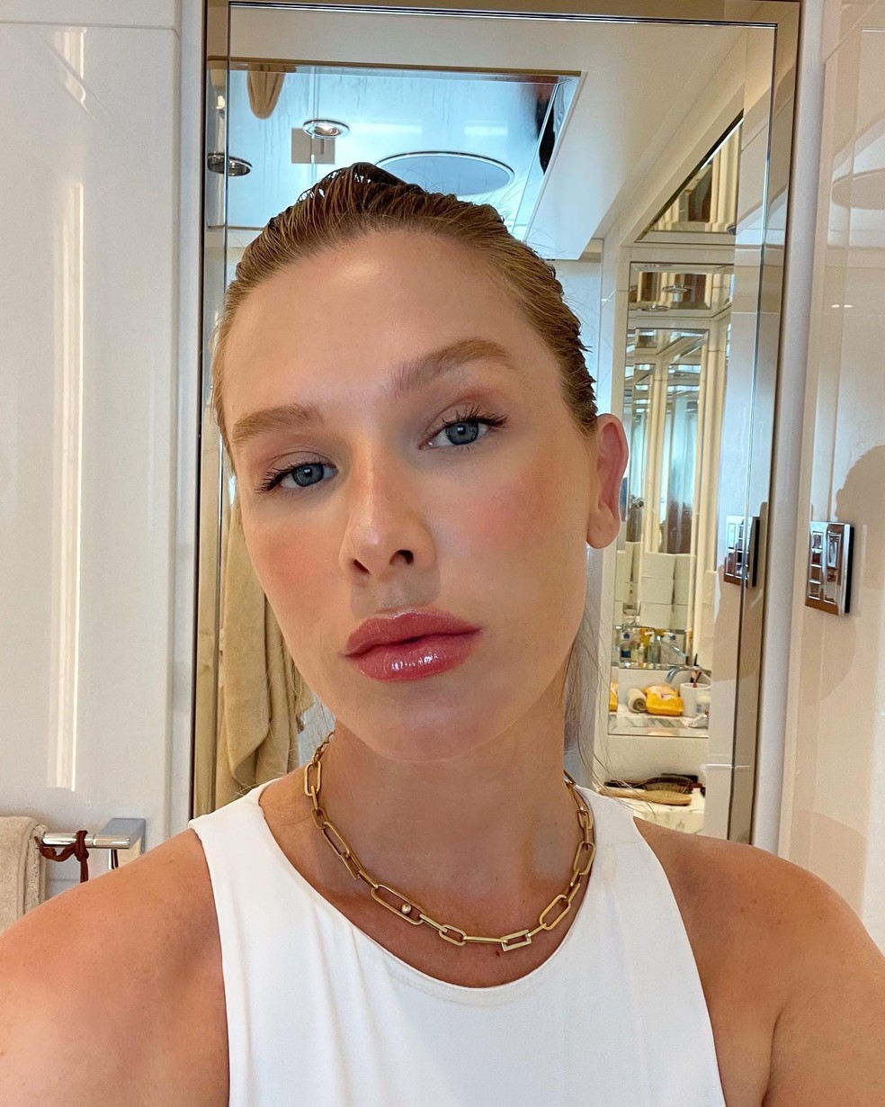 Fiorella removeu as próteses em 2021 — Foto: Instagram @fiorellamattheis