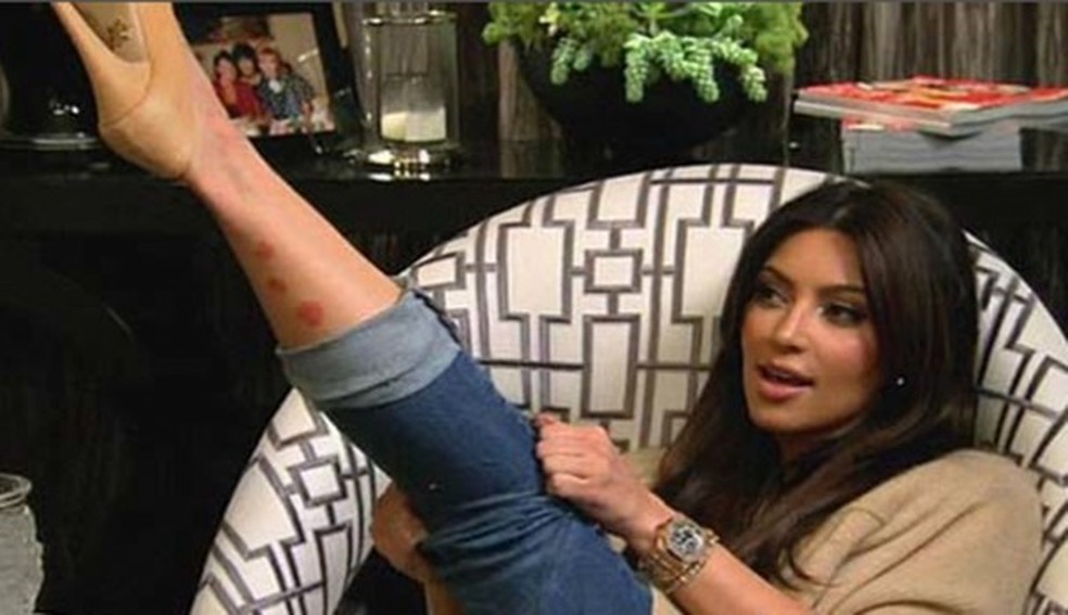 Kim Kardashian (Foto: Reprodução Instagram) — Foto: Glamour