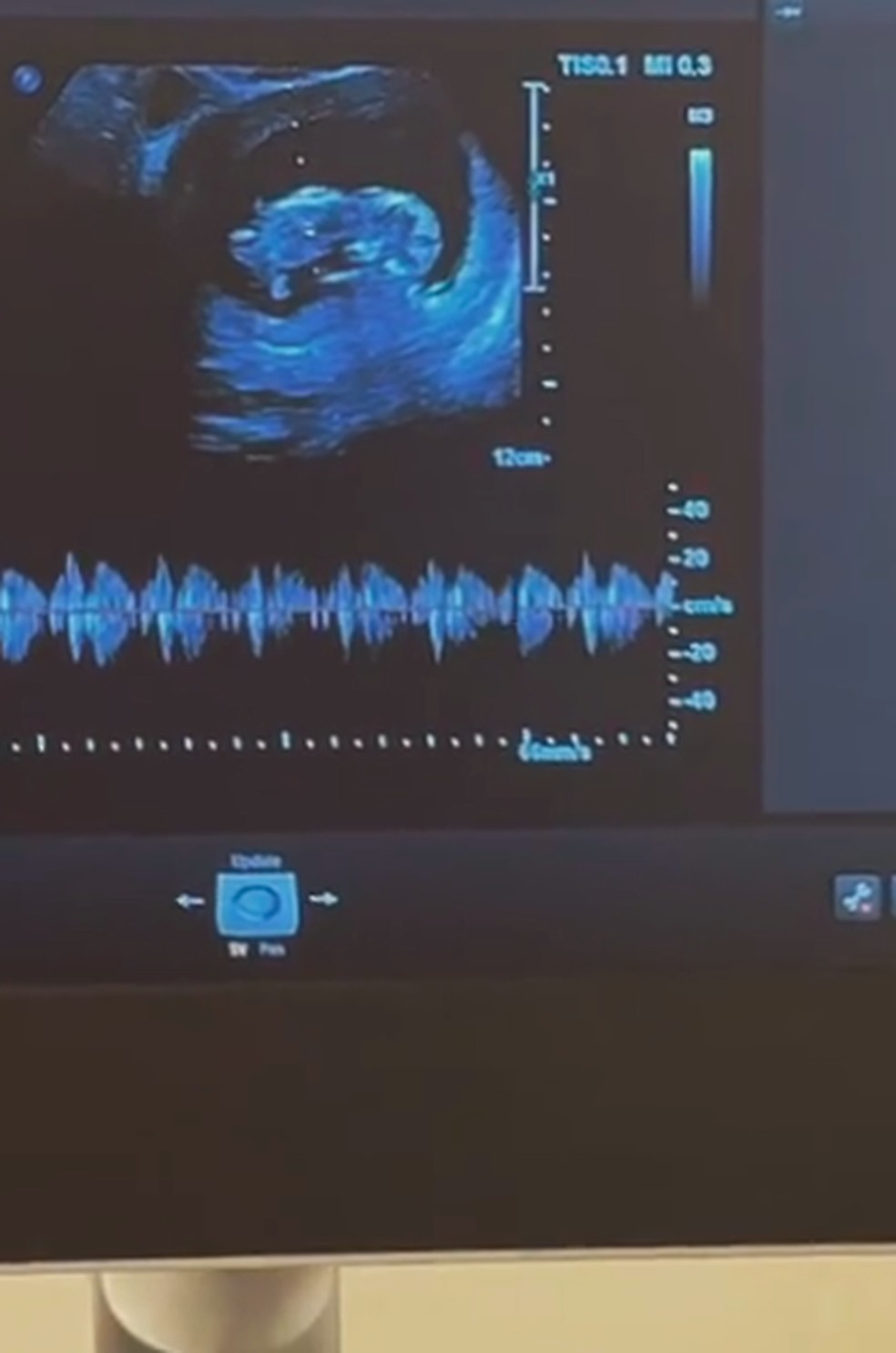 Cintia Dicker mostra ultrassom — Foto: Reprodução/Instagram