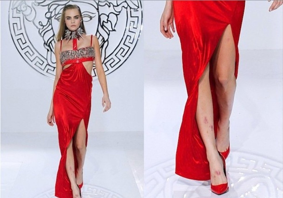 Cara Delevigne (Foto: Imaxtree) — Foto: Glamour