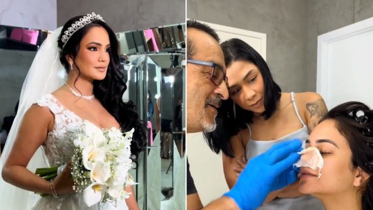 Maquiadora viraliza ao aplicar prótese de nariz em noiva que passou por cirurgia mal sucedida