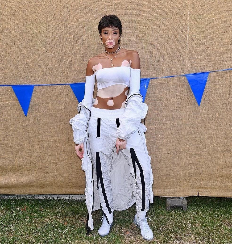 Winnie Harlow (Foto: Instagram/Reprodução) — Foto: Glamour