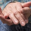 Unhas estriadas: o que são, por que aparecem e quando se preocupar - Getty Images