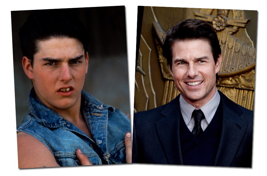 Tom Cruise em 1983 não se parece em nada com o que ele é hoje, né? Bem melhor agora!