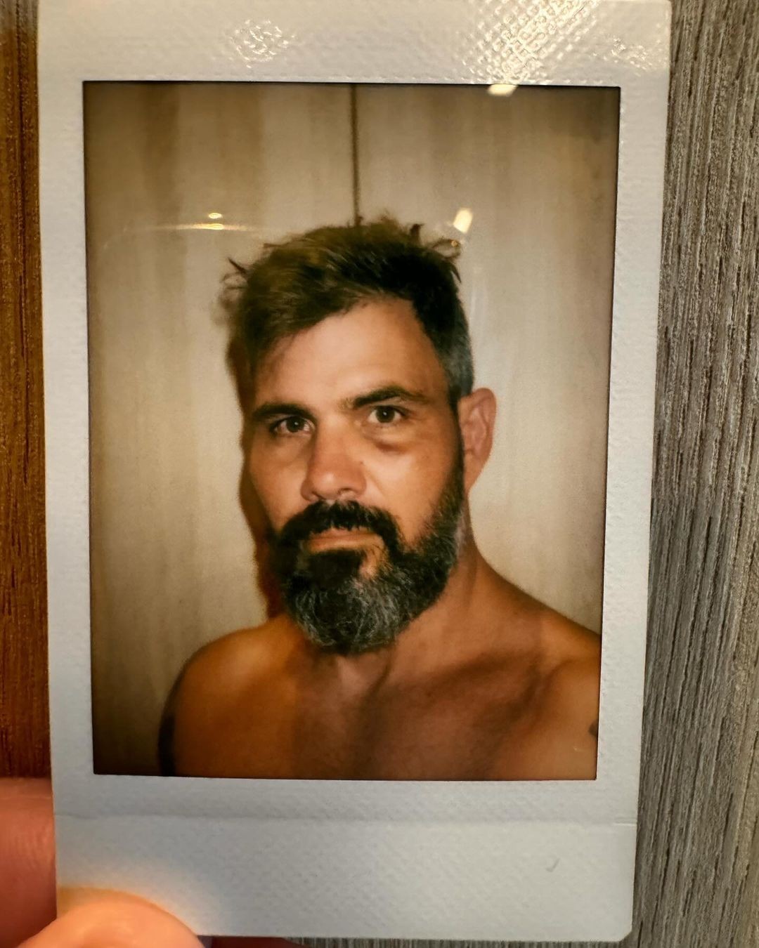 Juliano Cazarré surge com olho roxo e fãs reagem a explicação: 'Caramba'