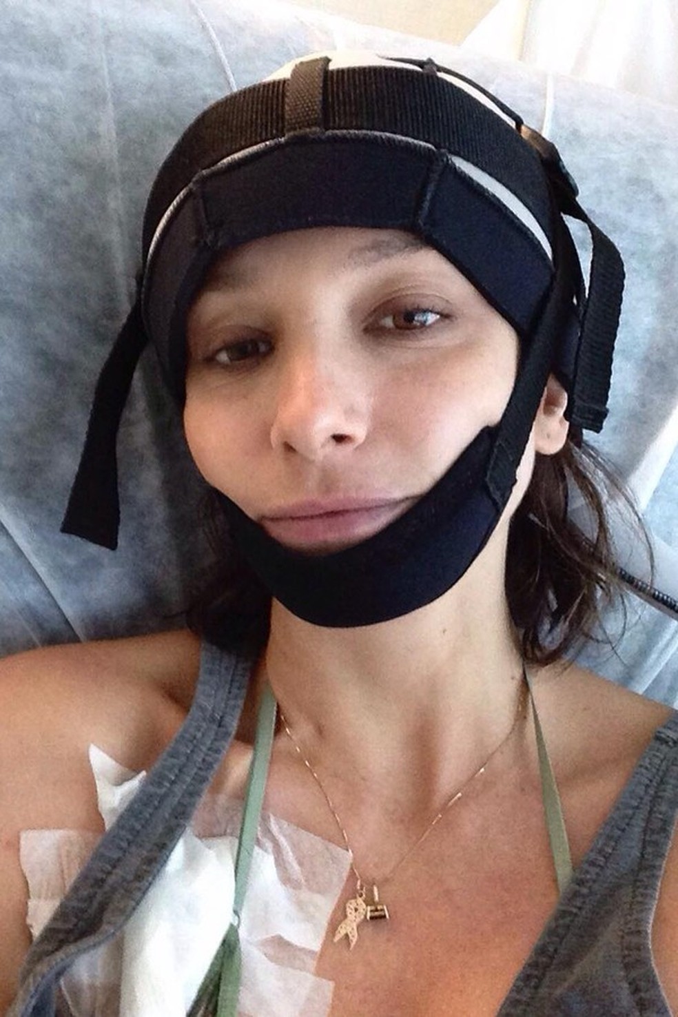 Sabrina Parlatore durante a quimioterapia (Foto: Reprodução/Instagram) — Foto: Glamour