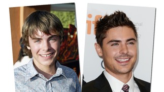 Zac Efron juntou os dentes da frente e ficou com o rosto menos infantil, não acham?